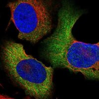 Anti-CCT6A antibody produced in rabbit HPA049949-100UL