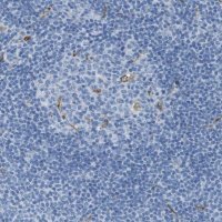 Anti-CD320 antibody produced in rabbit 