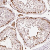 Anti-CDC123 antibody produced in rabbit 