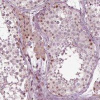 Anti-CDC14A antibody produced in rabbit 