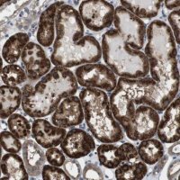 Anti-CDC34 antibody produced in rabbit 
