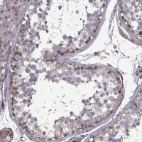 Anti-CDC42BPA antibody produced in rabbit 