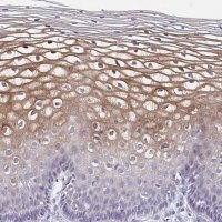Anti-CDC42BPG antibody produced in rabbit 