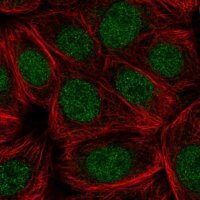 Anti-CDC73 antibody produced in rabbit 