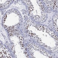Anti-CDCA2 antibody produced in rabbit
