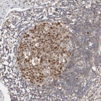 Anti-CDCA7L antibody produced in rabbit 