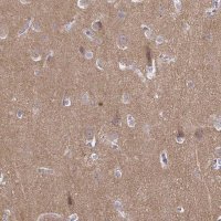 Anti-CDH18 antibody produced in rabbit 