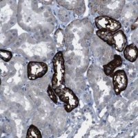 Anti-CDH22 antibody produced in rabbit 