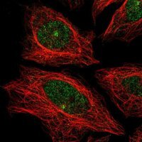 Anti-CDH24 antibody produced in rabbit 