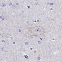 Anti-CDH9 antibody produced in rabbit 