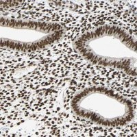 ANTI-CDK12 antibody produced in rabbit 