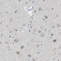 Anti-CDK14 antibody produced in rabbit 