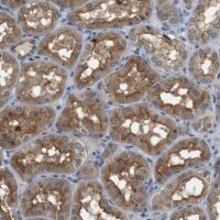 Anti-CDK14 antibody produced in rabbit 