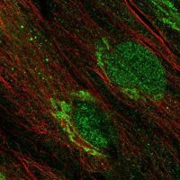 ANTI-CDK15 antibody produced in rabbit 