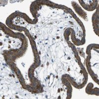 Anti-CDK17 antibody produced in rabbit