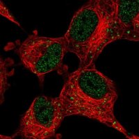 Anti-CDK5R1 antibody produced in rabbit 