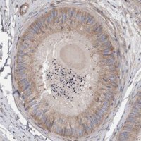 Anti-CDK5RAP3 antibody produced in rabbit 