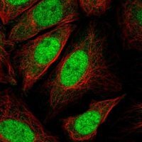 Anti-CDKN1B antibody produced in rabbit 