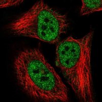 Anti-CDKN2AIP antibody produced in rabbit 