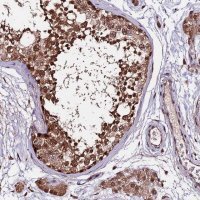 Anti-CDKN2AIP antibody produced in rabbit HPA041397-100UL