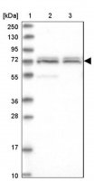 Anti-CDKN2AIP antibody produced in rabbit HPA041397-100UL