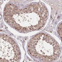 Anti-CDKN2AIPNL antibody produced in rabbit 