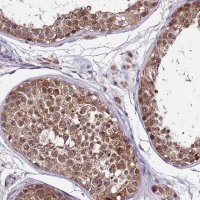 Anti-CDNF antibody produced in rabbit 