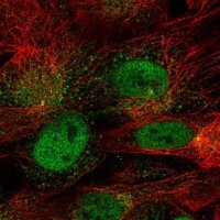 Anti-CDR1 antibody produced in rabbit 