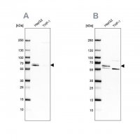 Anti-CDR2 antibody produced in rabbit