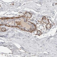 Anti-CDR2 antibody produced in rabbit