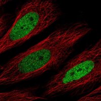 Anti-CEBPD antibody produced in rabbit 