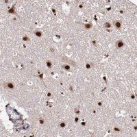 Anti-CECR2 antibody produced in rabbit
