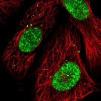 Anti-CECR2 antibody produced in rabbit