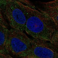 Anti-CELA3A antibody produced in rabbit 
