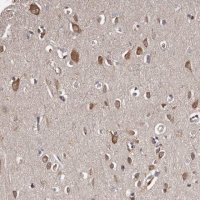 Anti-CELF3 antibody produced in rabbit