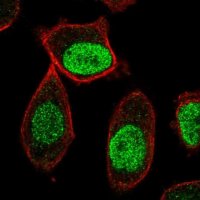 Anti-CENPA antibody produced in rabbit 