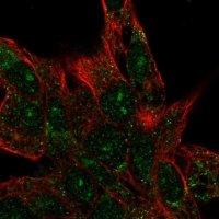 Anti-CENPBD1 antibody produced in rabbit 