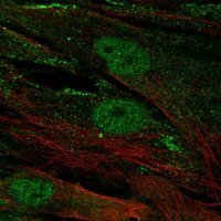Anti-CENPJ antibody produced in rabbit 