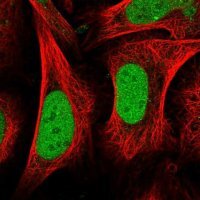 Anti-CENPQ antibody produced in rabbit 