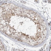 Anti-CEP295NL antibody produced in rabbit 