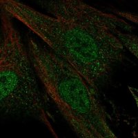 Anti-CERKL antibody produced in rabbit 