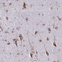 Anti-CERS1 antibody produced in rabbit 