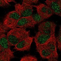 Anti-CERS6 antibody produced in rabbit 