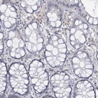 Anti-CETN1 antibody produced in rabbit