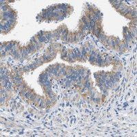 Anti-CFAP20 antibody produced in rabbit