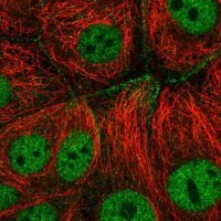 Anti-CFAP206 antibody produced in rabbit 
