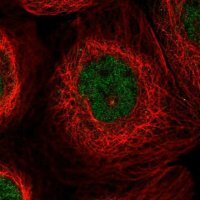 Anti-CFAP45 antibody produced in rabbit