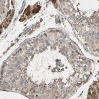 Anti-CFAP61 antibody produced in rabbit 