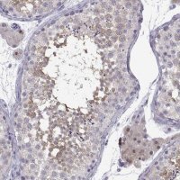 Anti-CFAP70 antibody produced in rabbit 
