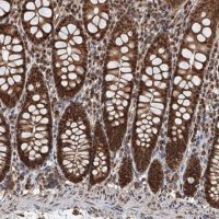 Anti-CFDP1 antibody produced in rabbit 